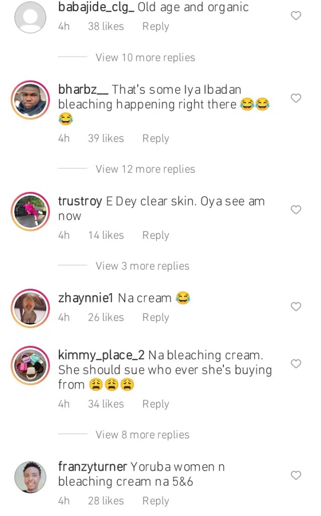 “E dey clear skin. Oya see am now”-Actress Nike Peller’s drastic transformation gets many talking
