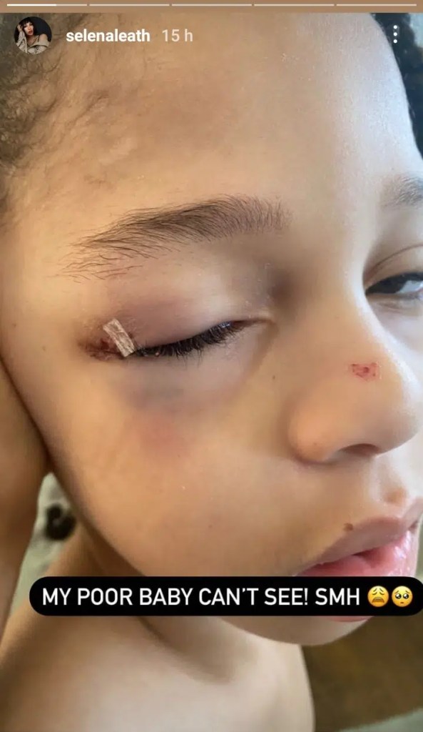 “My poor baby can’t see”– Singer Runtown’s son suffers eye injury