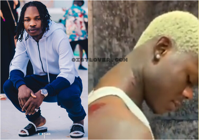 How Mohbad went on a biting spree after he got ‘high’ – Naira Marley speaks, shares proof [Video]